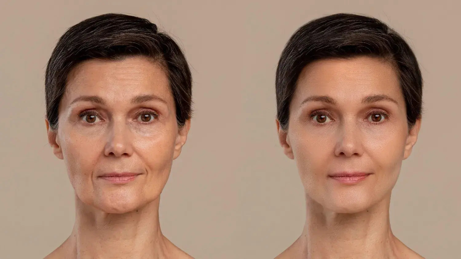 NAD+ Injections Before and After