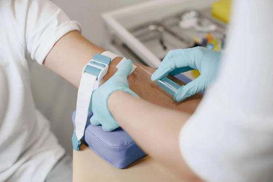 How do you measure NAD levels?